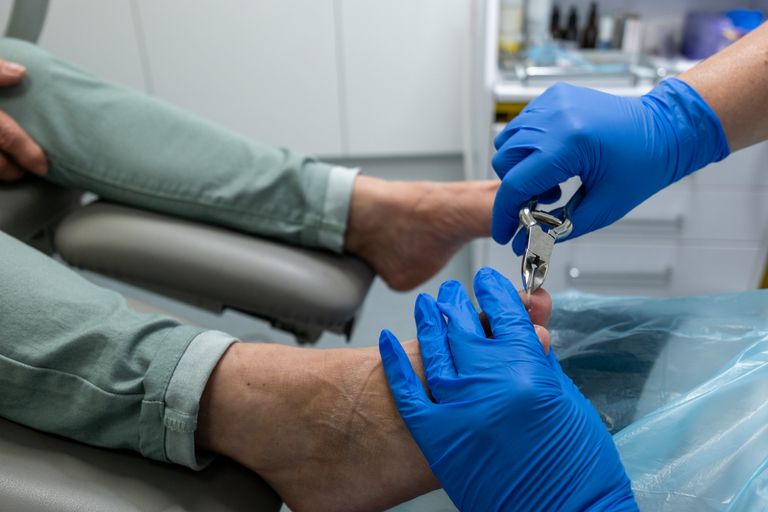 Podiatrist cutting toe nails in clinic 